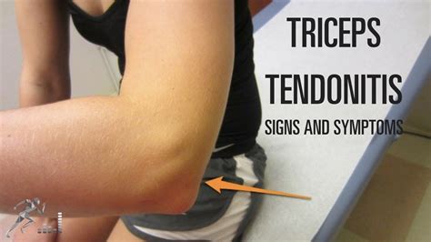 tricep tendonitis test